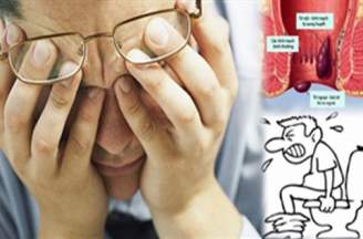 Dấu hiệu của bệnh trĩ ngoại nam giới