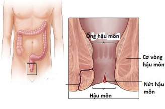 Điều trị nứt kẽ hậu môn bao lâu thì khỏi?